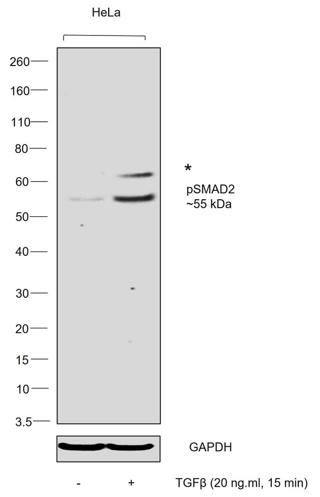 100UL PHOSPHO-SMAD2 (SER245/250/255) .