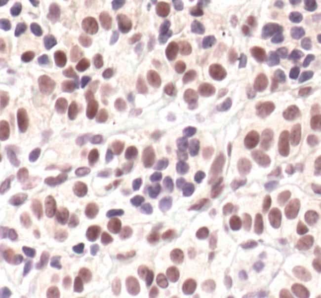 100UL PHOSPHO-CYCLIN E (THR62) .