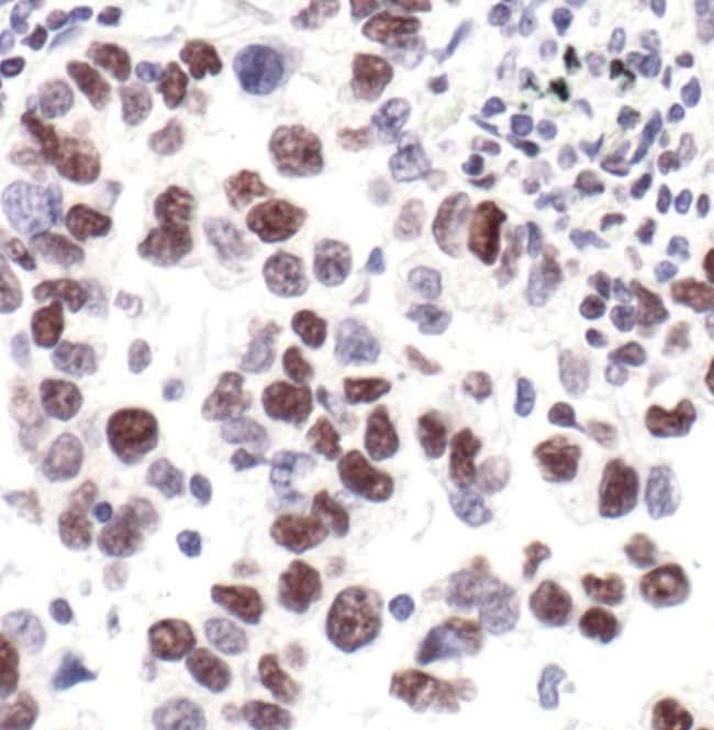 100UL PHOSPHO-RPB1 CTD (SER2/5) .