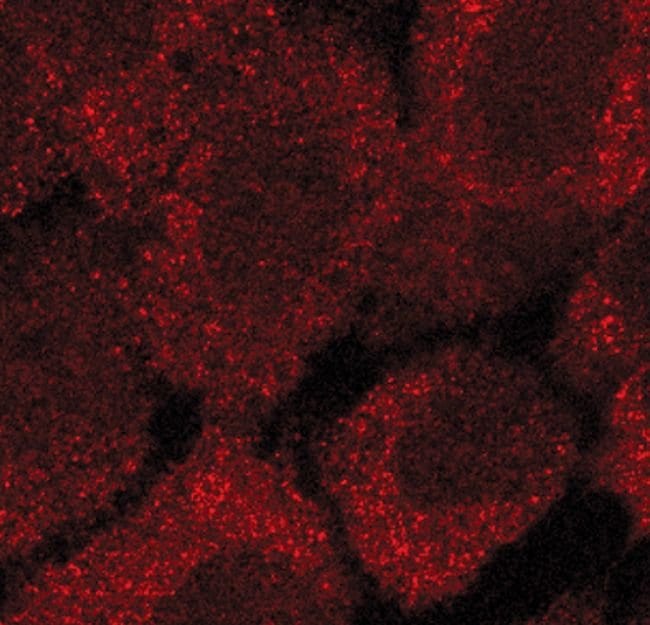 100UL ACETYL-COA CARBOXYLASE .