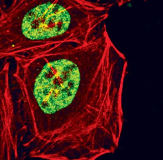 Antibody Phospho-Glucocorticoid Receptor