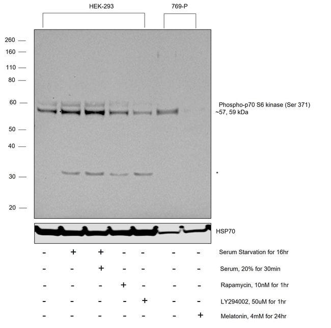 100UL PHOSPHO-P70 S6 KINASE (SER371) .