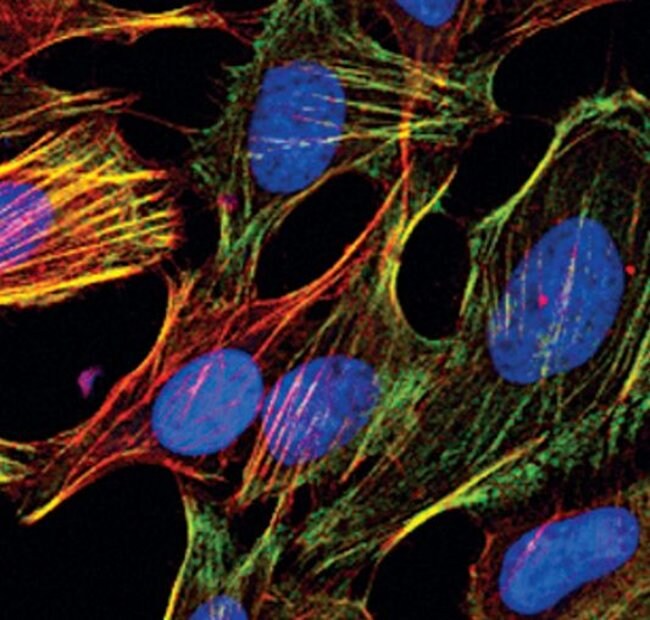 Antibody Phospho-Myosin Light Chain 2 (S