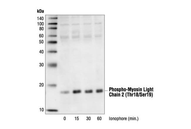 Antibody Phospho-Myosin Light Chain 2 (T