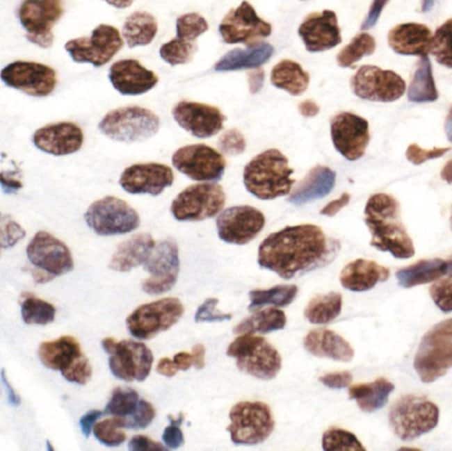 100UL ACETYL-HISTONE H2A (LYS5) .