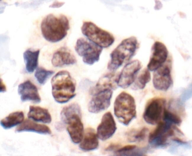 100UL PHOSPHO-MAPKAPK-2 (THR334) .