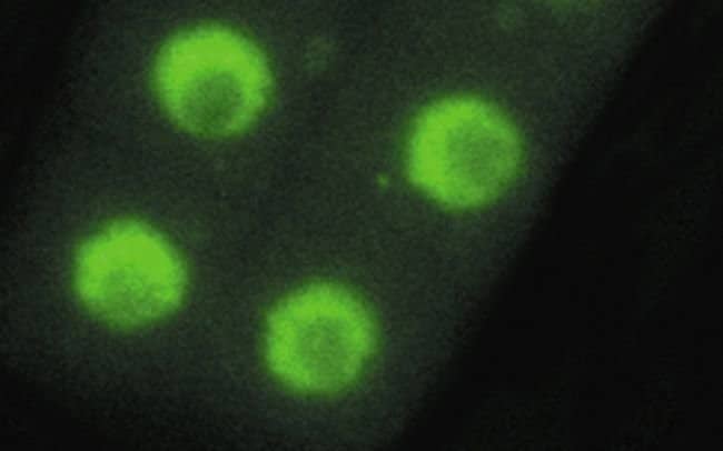 100UL ACETYL-HISTONE H2B (LYS20) .