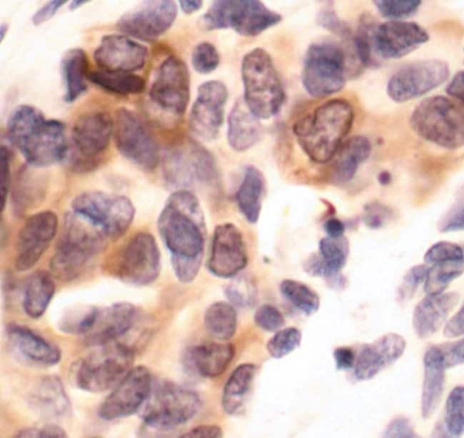 Antibody Phospho-PKCsigma/theta (Ser643/