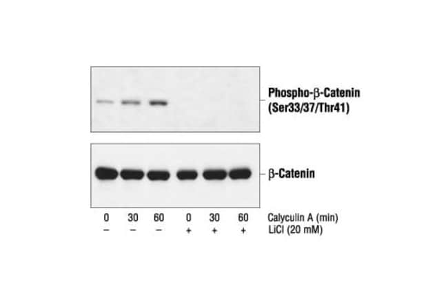Antibody Phospho-beta-Catenin (Ser33/37/