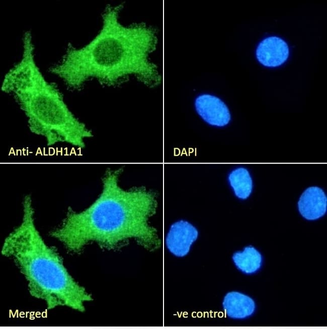 ALDH1A1 Polyclonal Antibody 100 µg