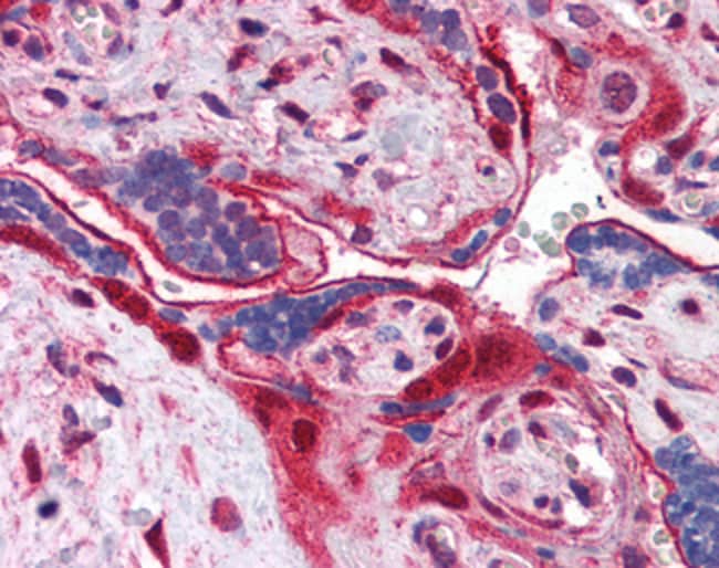 Annexin A11 Polyclonal Antibody 100 µg A