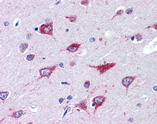 Alsin/ALS2 Polyclonal Antibody 100 µg