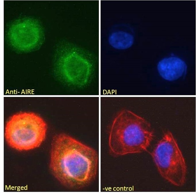 AIRE Polyclonal Antibody 100 µg µG