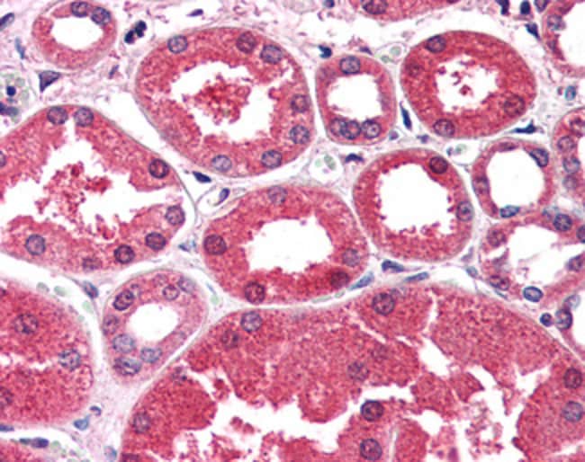 Aldehyde Reductase Polyclonal  Antibody