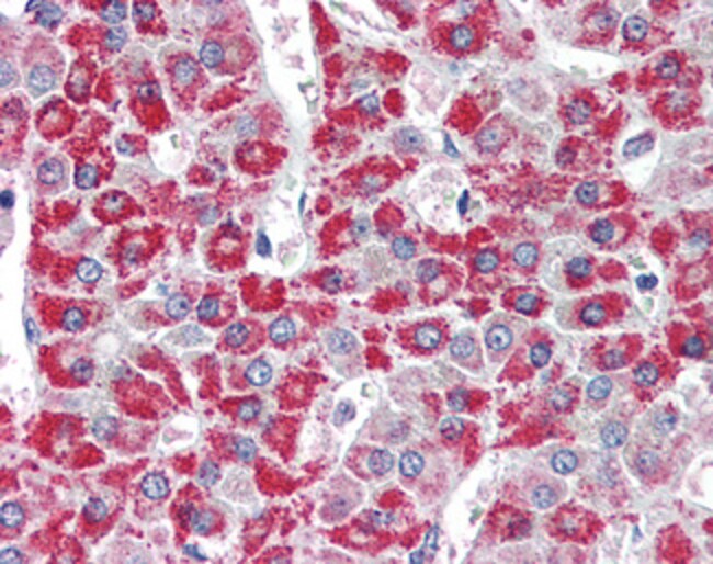 ACADM Polyclonal Antibody 100 µg µG