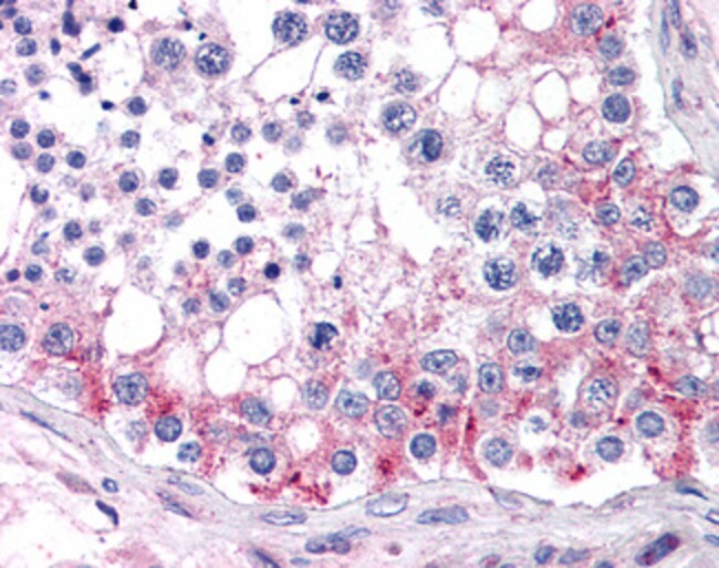 ABCB9/TAPL Polyclonal Antibody 100 µg