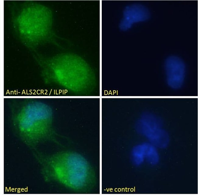 ALS2CR2/ILPIP Polyclonal Antibody 100 µg