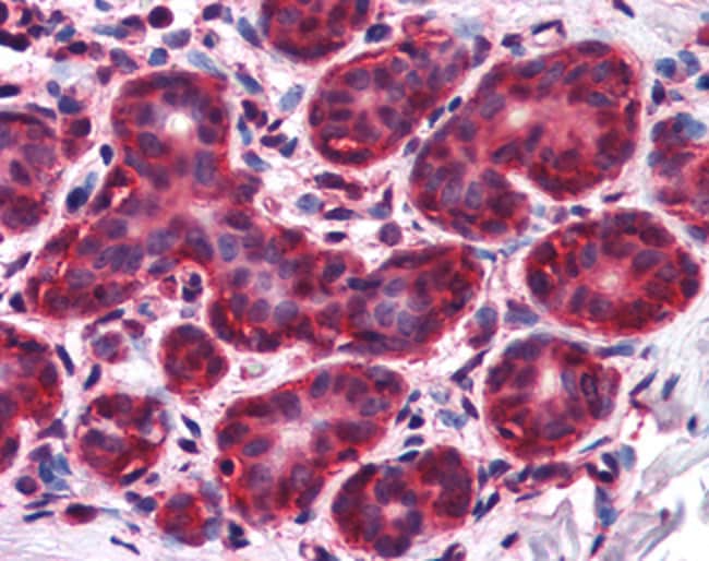 ALS2CR1/NIF3L1 Polyclonal Antibody 100 µ