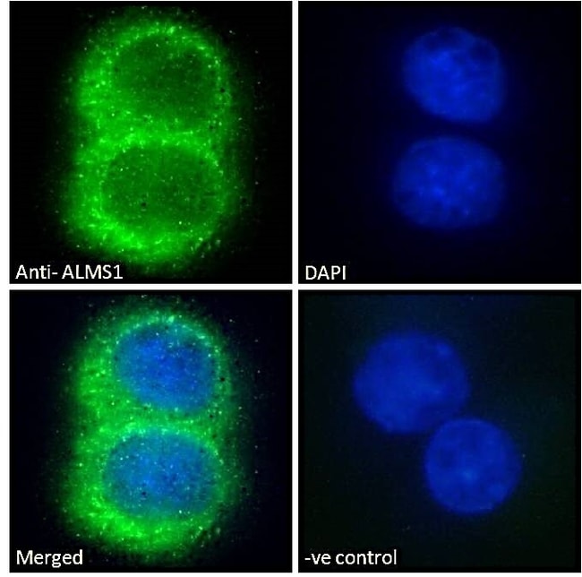 ALMS1 Polyclonal Antibody 100 µg µG