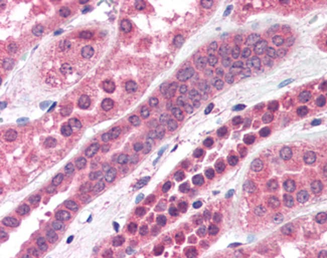 Amisyn/STXBP6 Polyclonal Antibody 100 µg