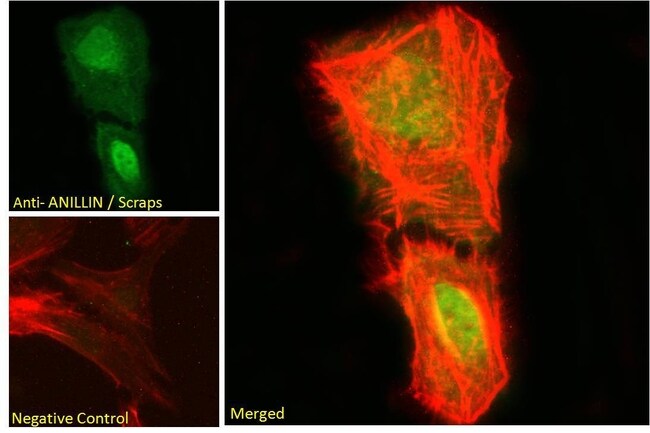 ANILLIN /Scraps Polyclonal Antibody 100