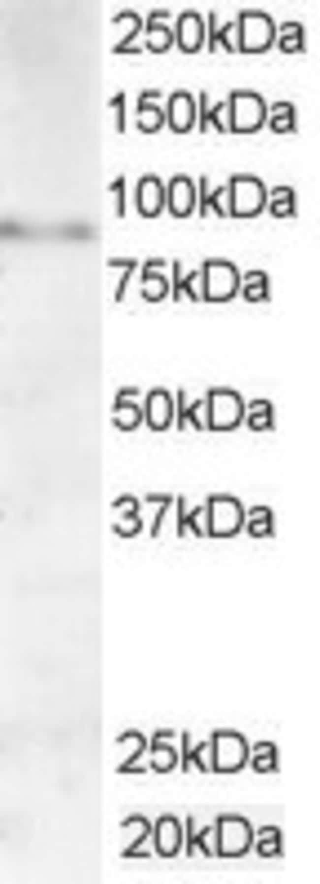 AKAP3/SOB1 Polyclonal Antibody 100 µg