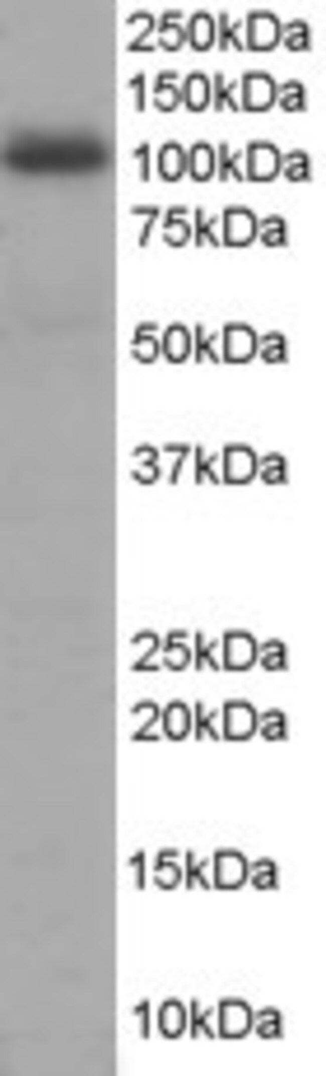 AKAP8/AKAP95 Polyclonal Antibody 100 µg
