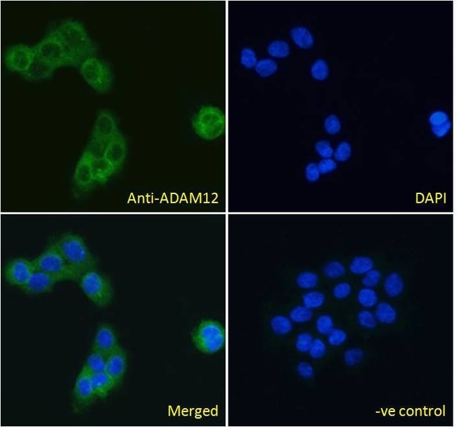 ADAM12 Polyclonal Antibody 100 µg µG