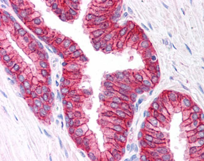 ABCC4/MRP4 Polyclonal Antibody 100 µg