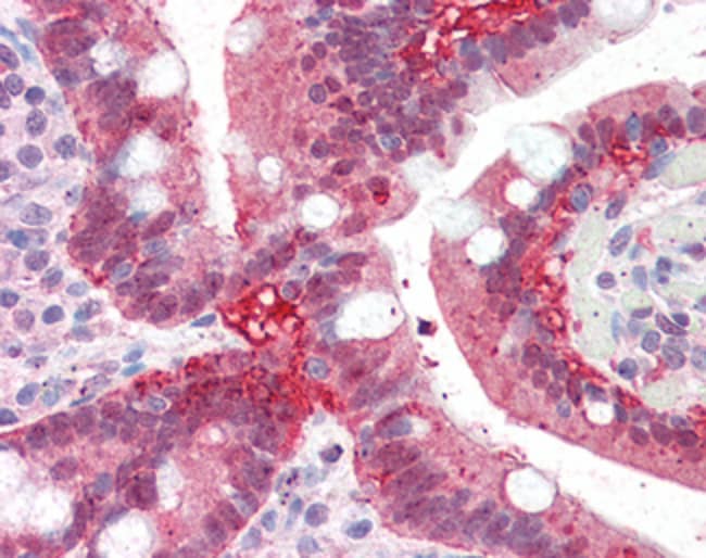 AKR1C3 Polyclonal Antibody 100 µg µG
