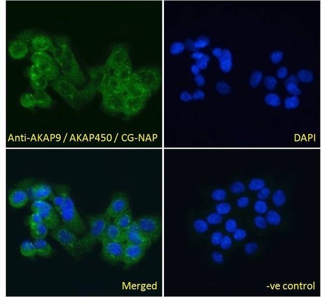 AKAP9/AKAP450/CG-NAP Polyclonal Antibody