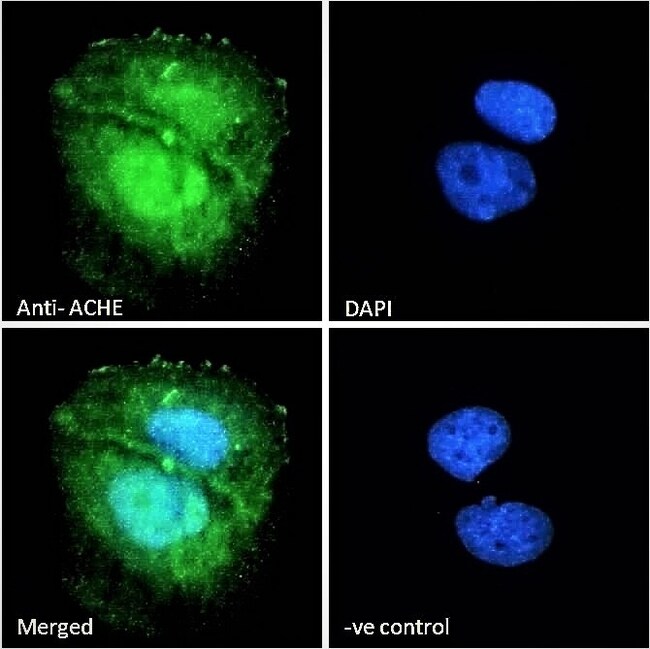 ACHE Polyclonal Antibody 100 µg µG