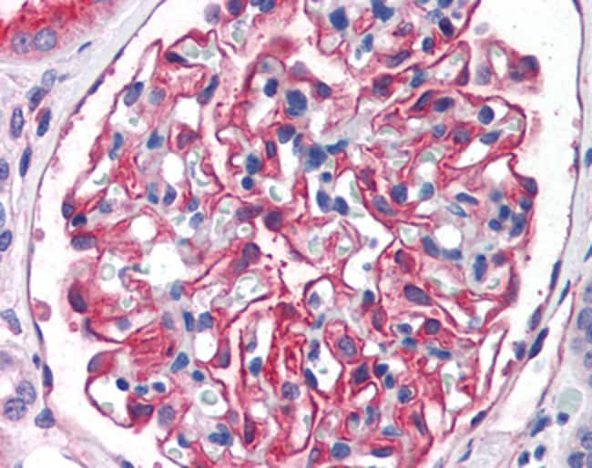 Aminopeptidase A Polyclonal Antib. 100 µ