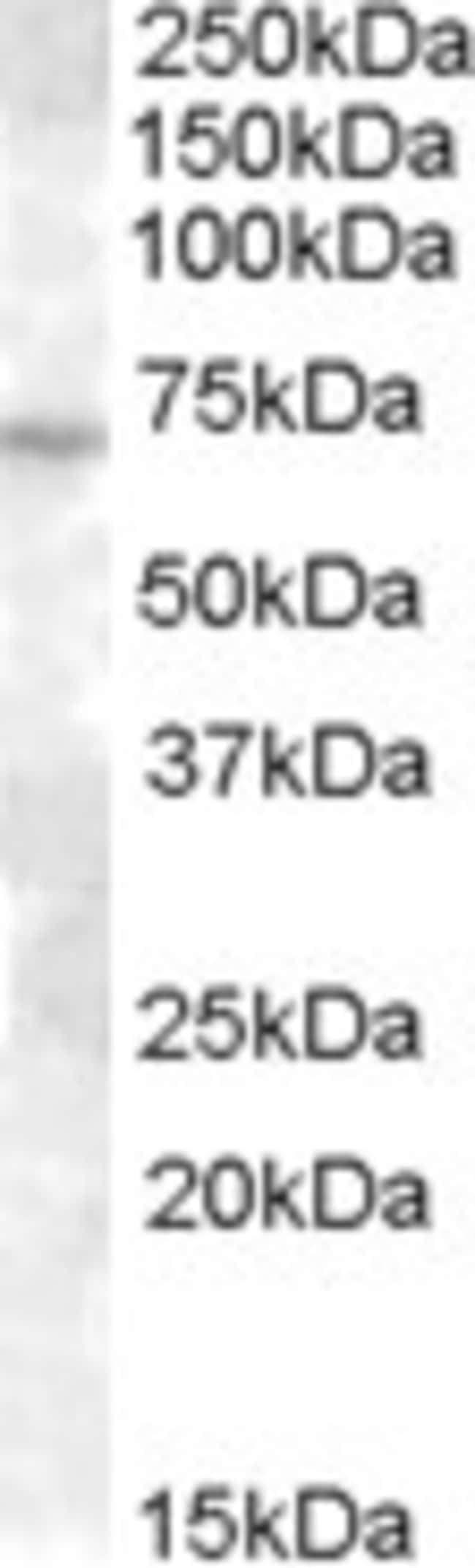 ABCE1/ RNAse L inhibitor Polyclonal Anti