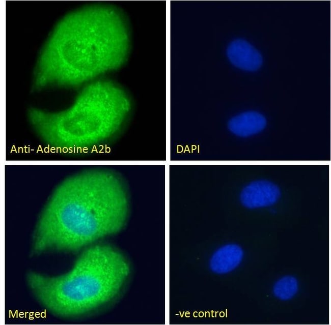 Adenosine A2b Receptor Polyclonal Antibo