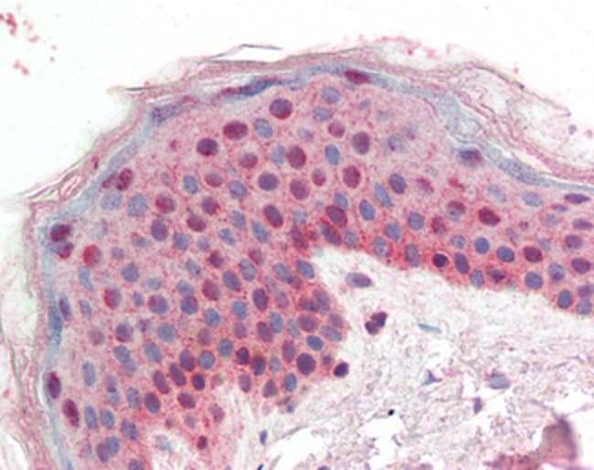 4-3-3 sigma/Stratifin Polyclonal Antibod