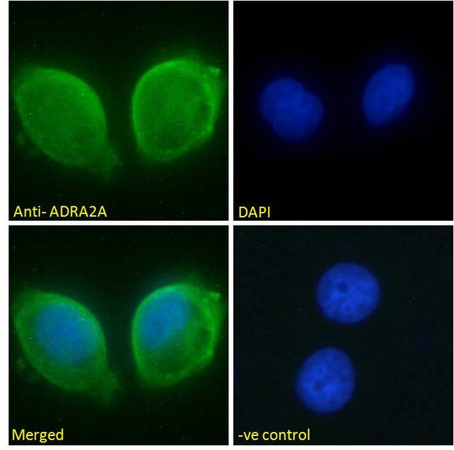 ADRA2A Polyclonal Antibody 100 µg µG