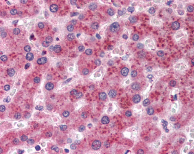AKR1C4 Polyclonal Antibody 100 µg µG