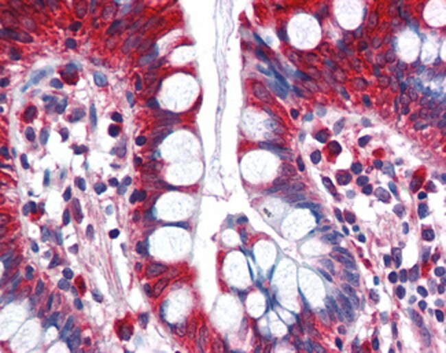 ACSL5 Polyclonal Antibody 100 µg µG