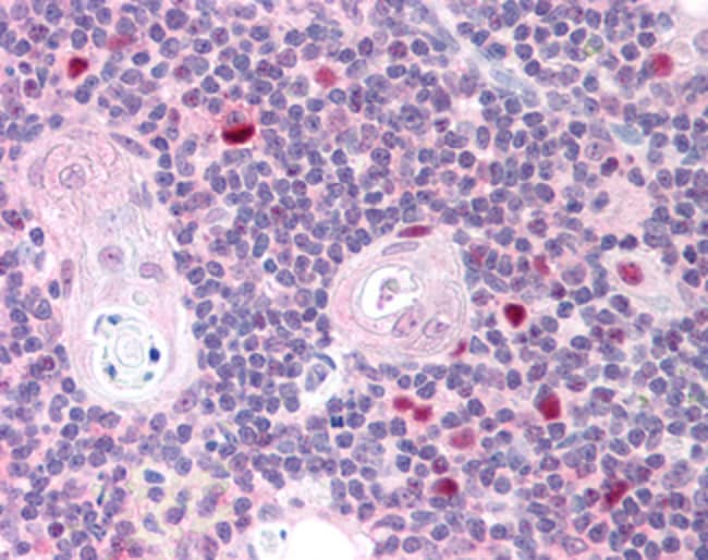 AIRE Polyclonal Antibody 100 µg µG