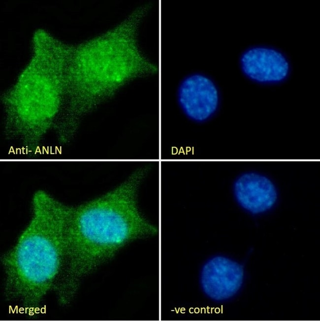 ANILLIN/Scraps Polyclonal Antibody 100 µ