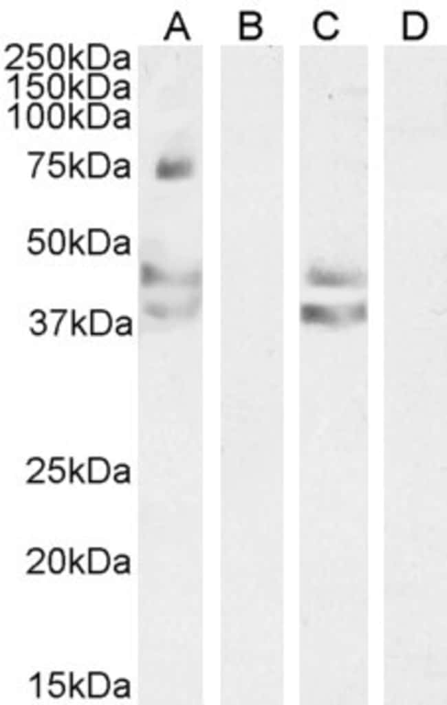AGTR1/AT1 Polyclonal Antibody 100 µg