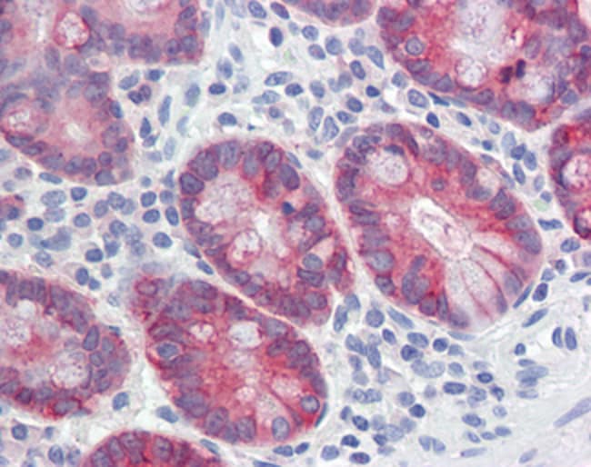 AGR2 Polyclonal Antibody 100 µg µG