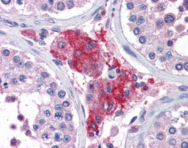 ACYP1 Polyclonal Antibody 100 µg µG