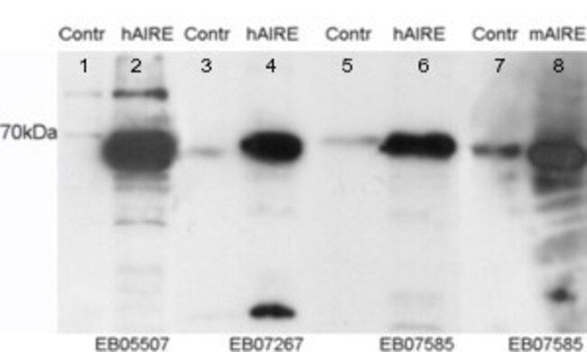 AIRE Polyclonal Antibody 100 µg
