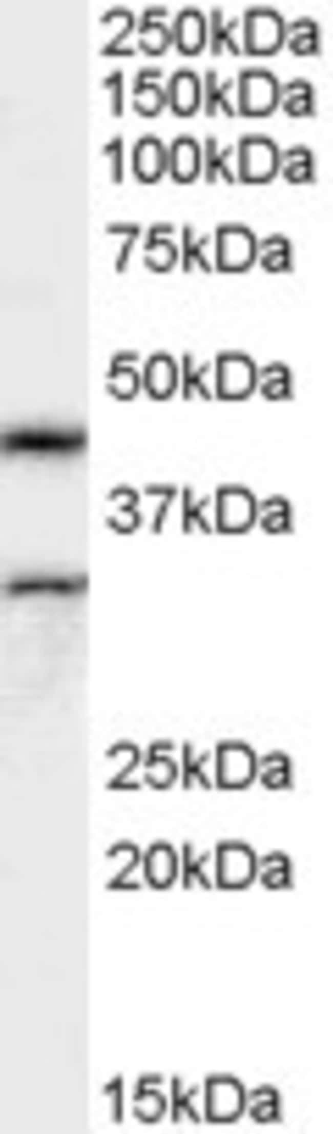 Actin-like 7B Polyclonal Antibody 100 µg
