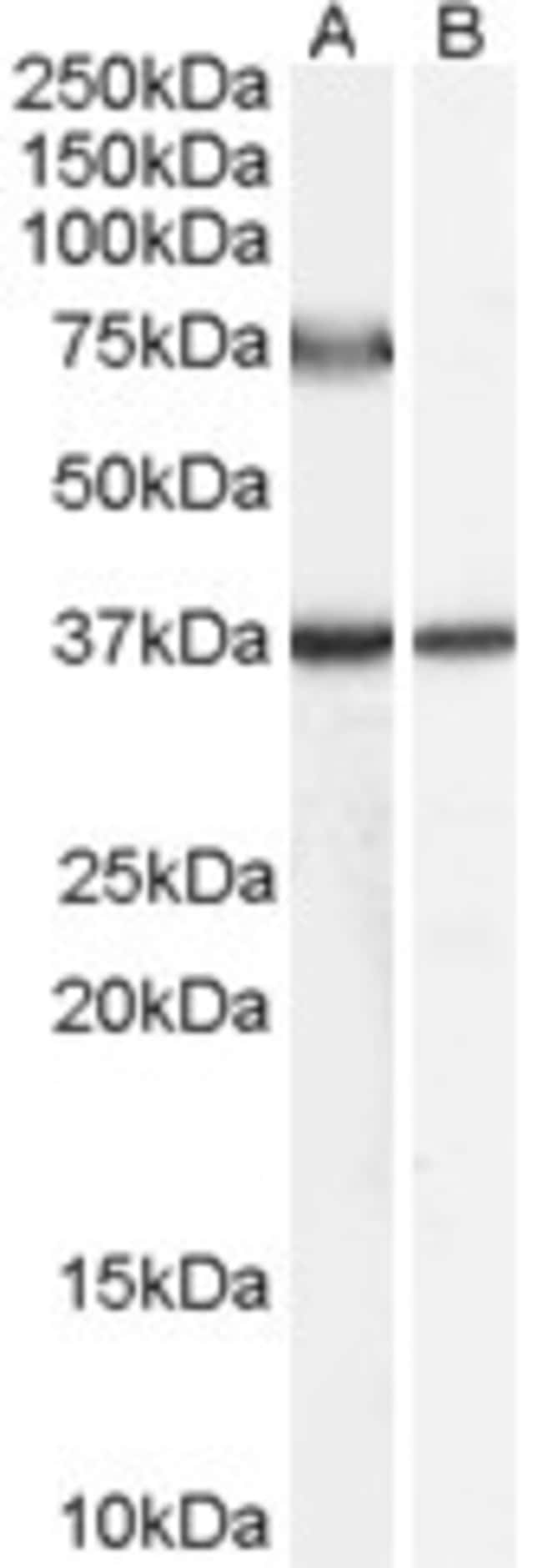 ACOX2 Polyclonal Antibody 100 µg µG