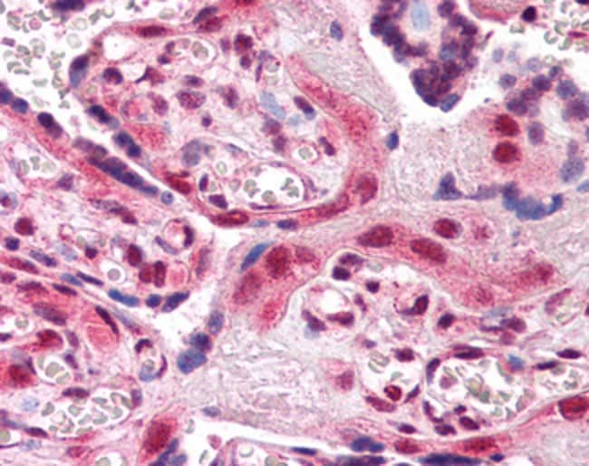 AIP/ARA9 Polyclonal Antibody 100 µg