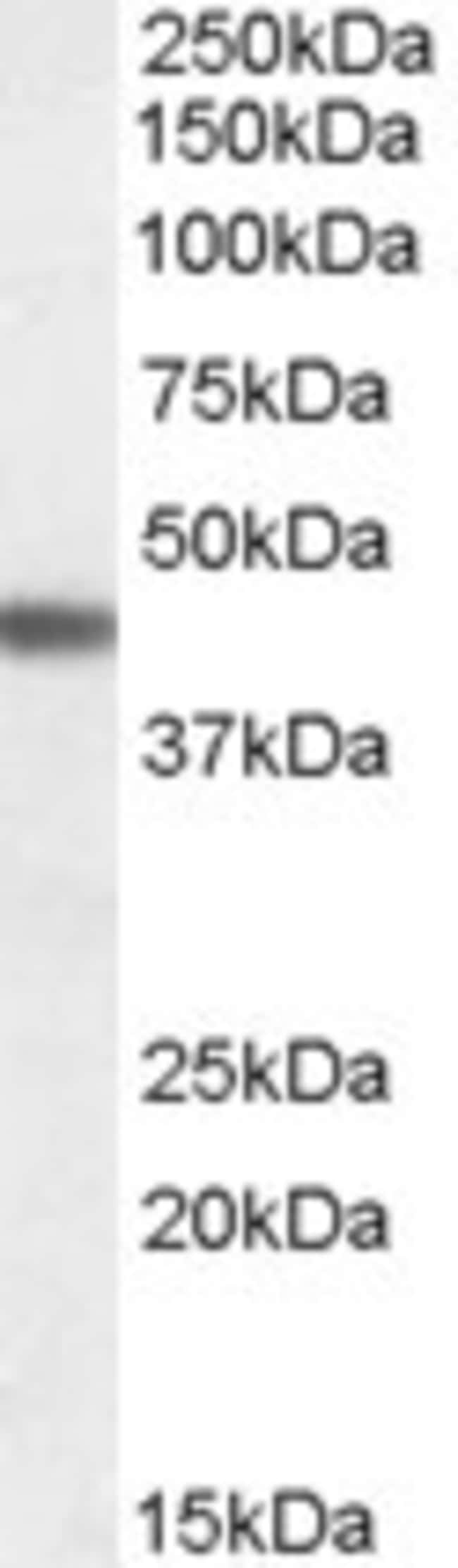 ADRB3 Polyclonal Antibody 100 µg µG