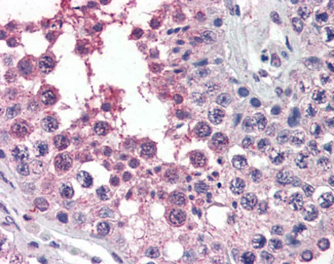 ACVR1 Polyclonal Antibody 100 µg µG
